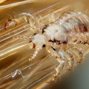 How To Keep Super Lice At Bay As Kids Go Back To School